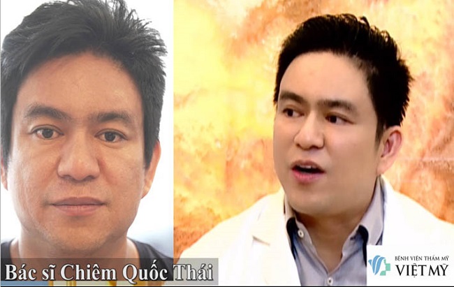Bác sĩ thẩm mỹ giỏi ở TPHCM – Bác sĩ Chiêm Quốc Thái